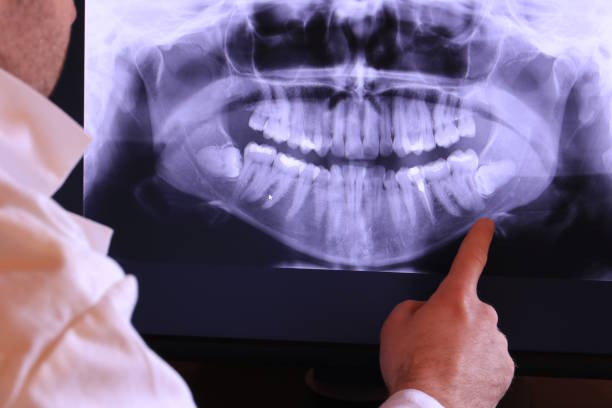 Best Emergency Dentist for Lost Fillings or Crowns in Hackensack, NJ